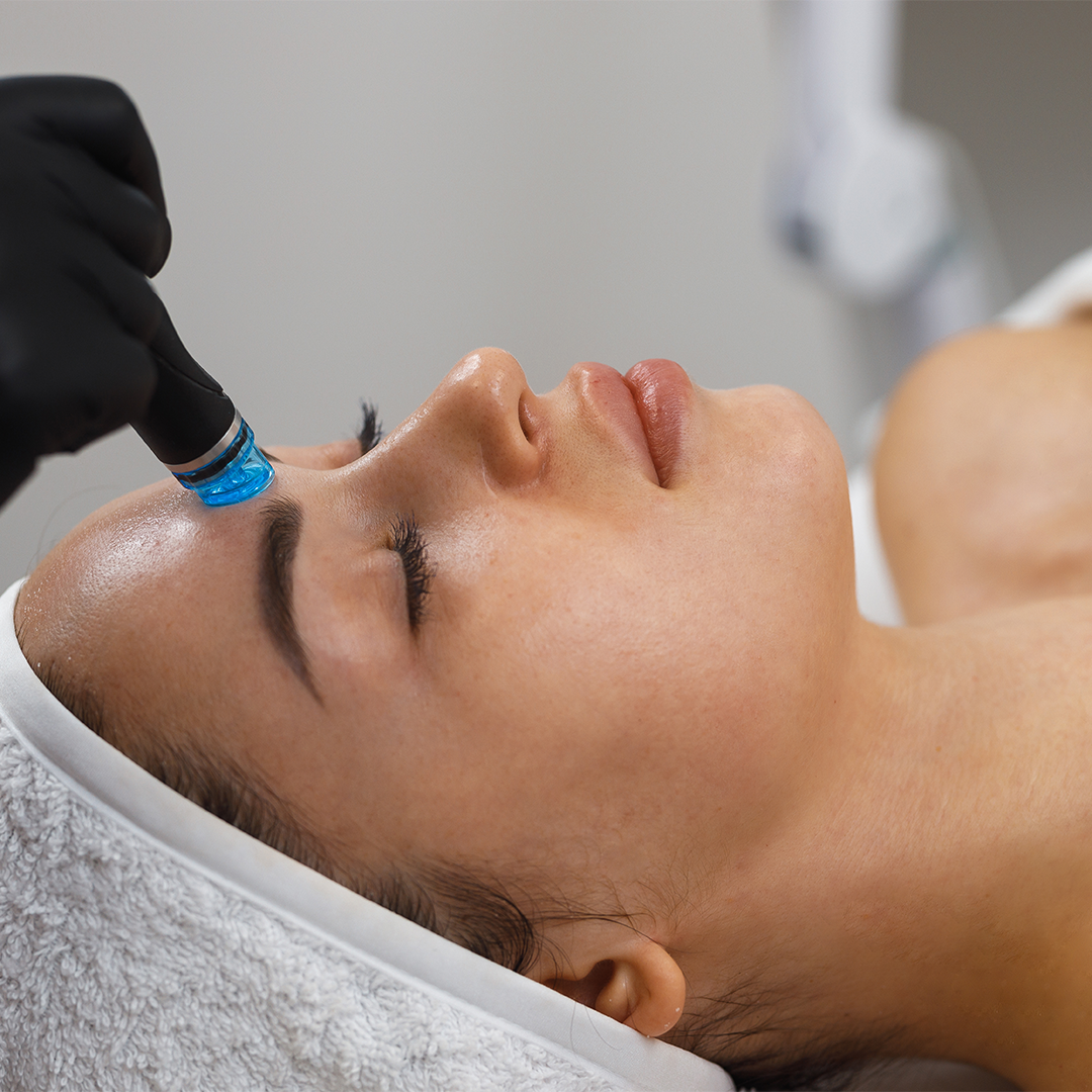 Deep cleansing with microneedling and specialized serums