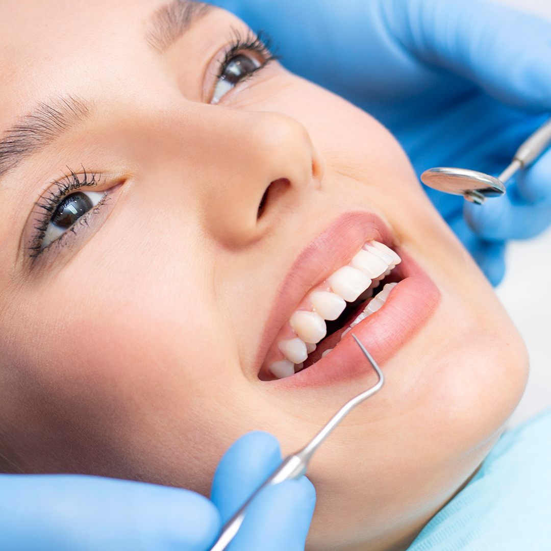 Dental Prophylaxis