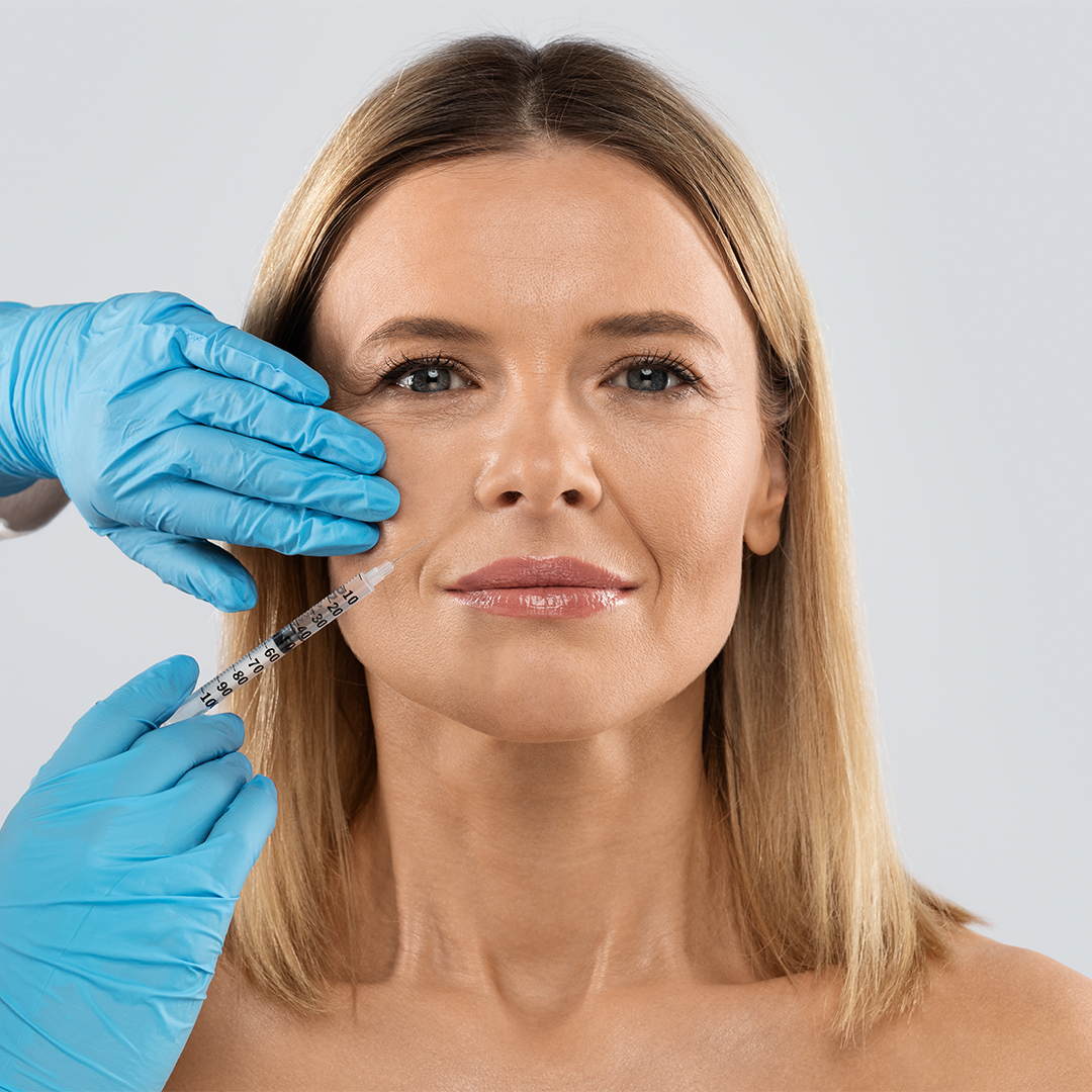 Nasolabial folds